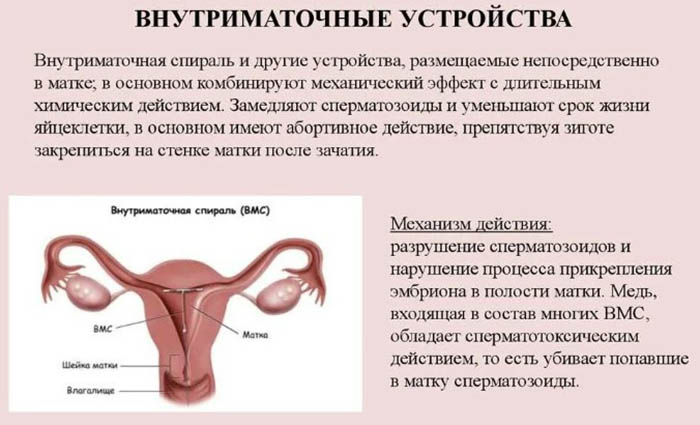 Внутриматочная контрацепция. Виды, показания, механизм действия