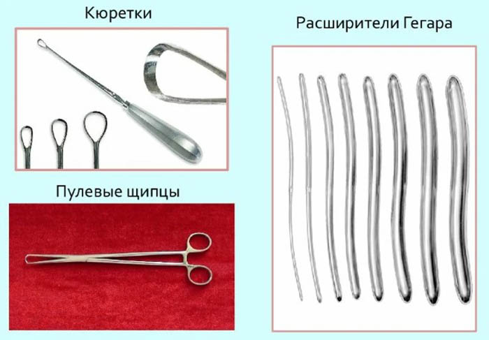 Выскабливание полости матки. Что это такое в гинекологии