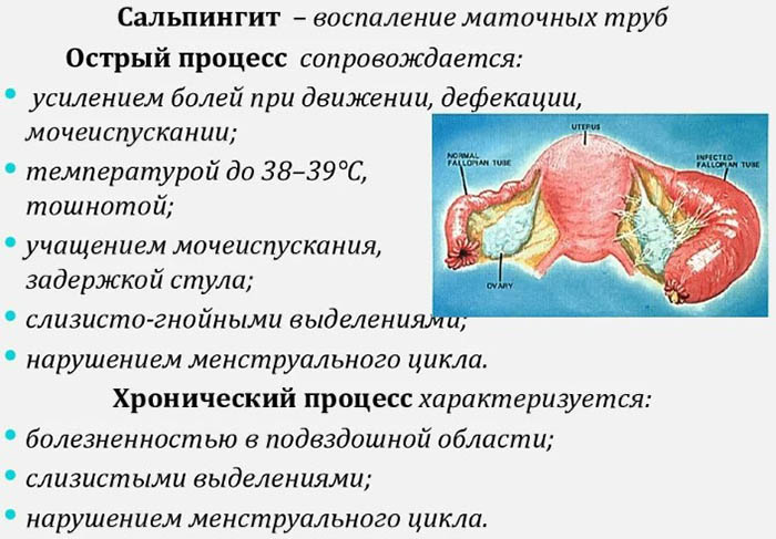 Выскабливание полости матки. Что это такое в гинекологии