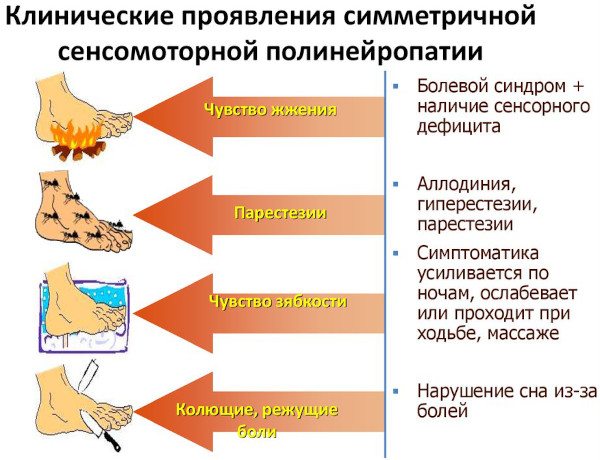 Заболевания периферической нервной системы. Список, классификация