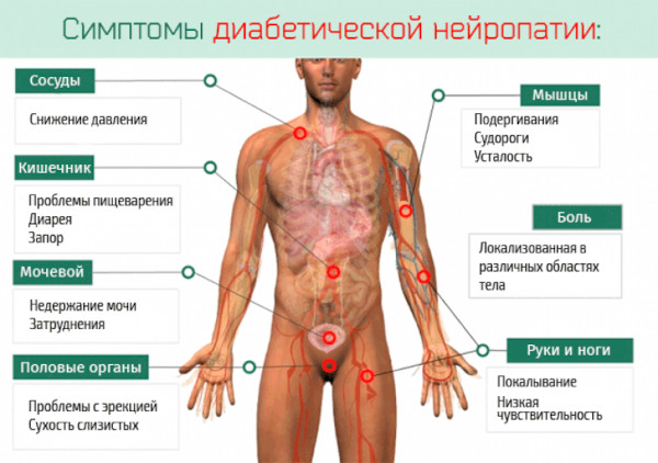 Заболевания периферической нервной системы. Список, классификация