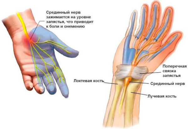 Заболевания периферической нервной системы. Список, классификация