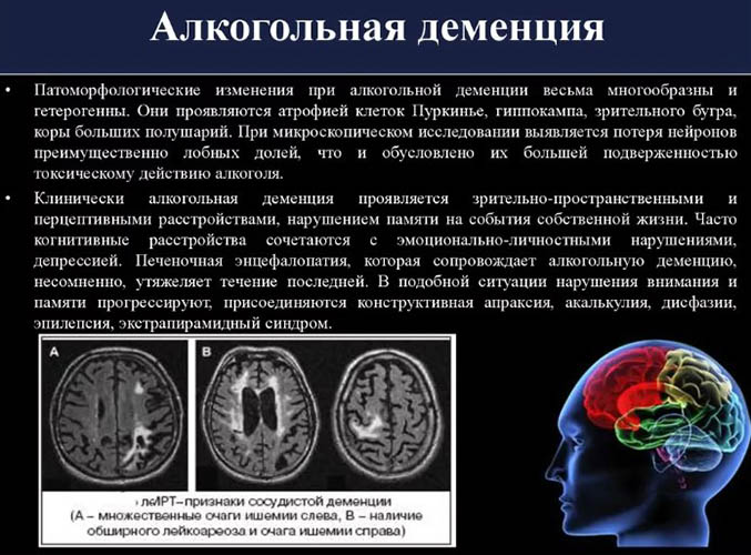 Алкогольная деменция (слабоумие). Что это, симптомы у мужчин