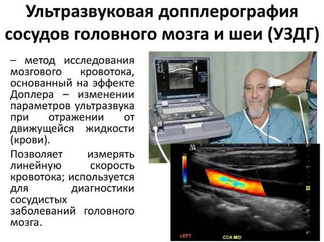 Алкогольный галлюциноз. Симптомы, что это, лечение