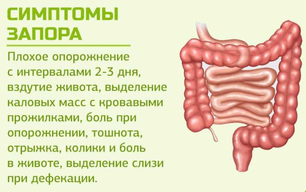 Атонический запор. Симптомы и лечение у взрослых