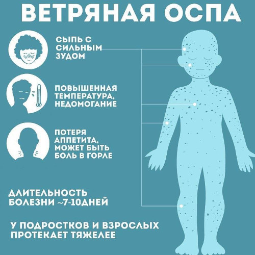 Ацикловир при ветрянке у детей. Дозировка, отзывы