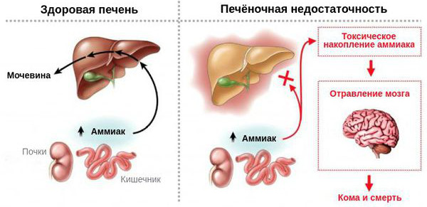 Ацикловир при ветрянке у детей. Дозировка, отзывы