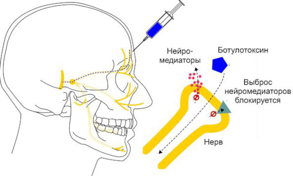 Блефароспазм в офтальмологии. Что это, причины, лечение