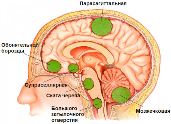 Болезни головного мозга. Список, симптомы, названия