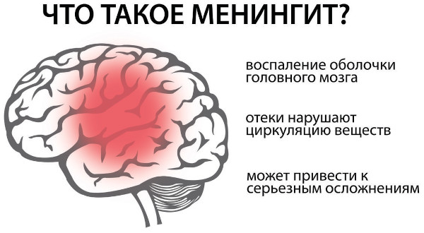 Болезни головного мозга. Список, симптомы, названия