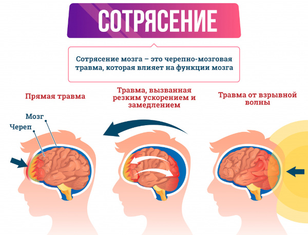 Болезни головного мозга. Список, симптомы, названия