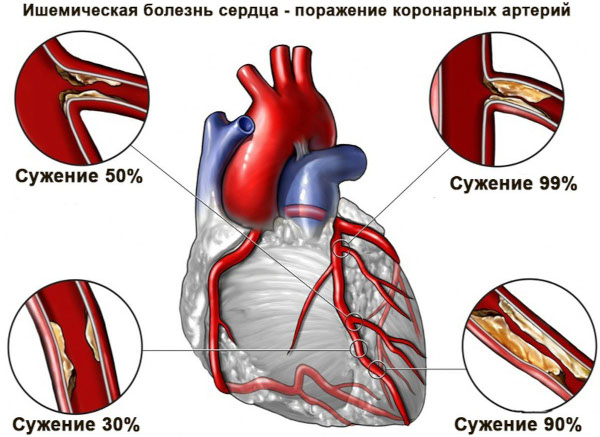 Дигоксин (Digoxin). Инструкция по применению, цена, отзывы