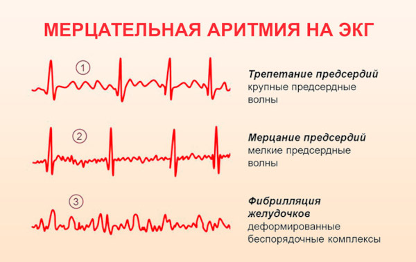 Дигоксин (Digoxin). Инструкция по применению, цена, отзывы