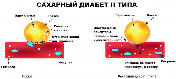 Фрукты при сахарном диабете 2 типа. Что можно, нельзя, список