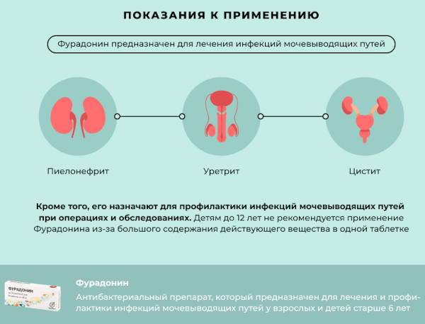 Фурадонин. Аналоги и заменители при цистите