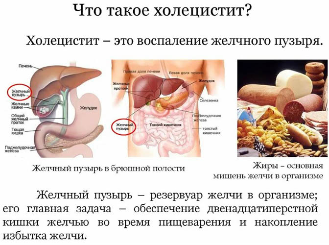 Холецистит при беременности 1-2-3 триместр. Симптомы и лечение