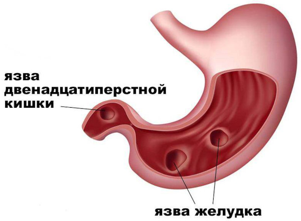 Нейродоз. Инструкция по применению, состав препарата