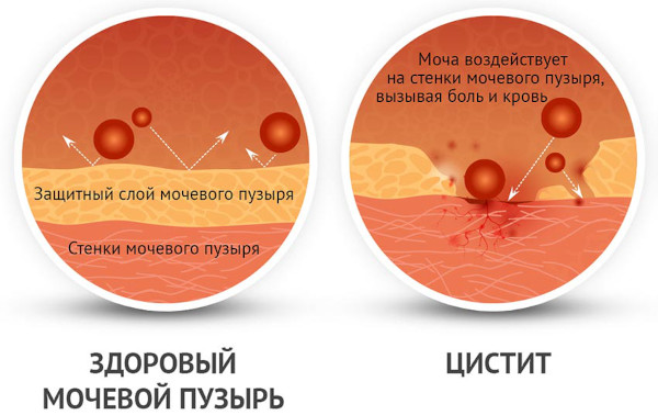 Нитроксолин таблетки. Инструкция по применению, цена, отзывы