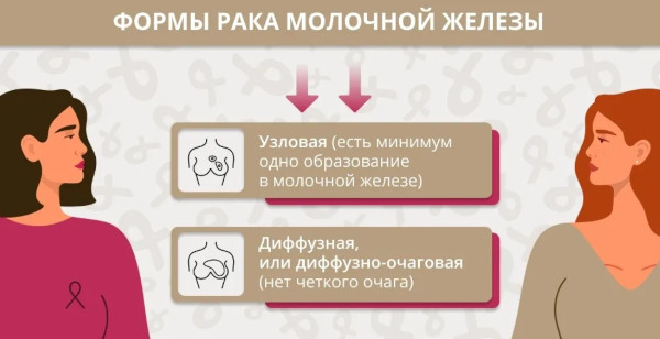 Опухоль молочной железы у женщин. Симптомы, признаки, лечение