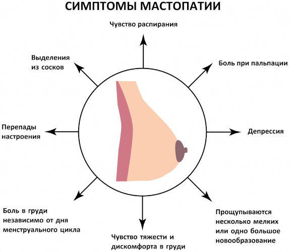 Опухоль молочной железы у женщин. Симптомы, признаки, лечение