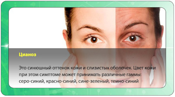 Пароксизмальная наджелудочковая тахикардия. Что это, лечение, препараты