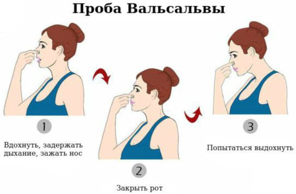 Пароксизмальная наджелудочковая тахикардия. Что это, лечение, препараты