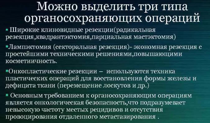 Радикальная резекция молочной железы. Что это такое, что значит