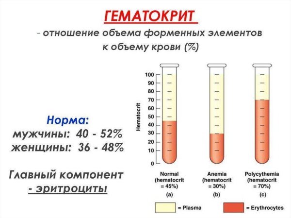 Демпинг-синдром. Что это такое в медицине