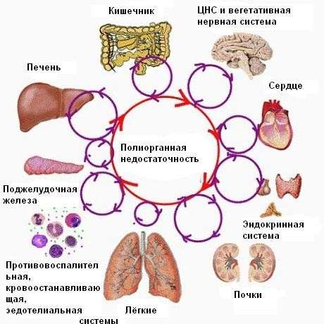 Гиповолемический шок. Что это такое, патогенез, причины