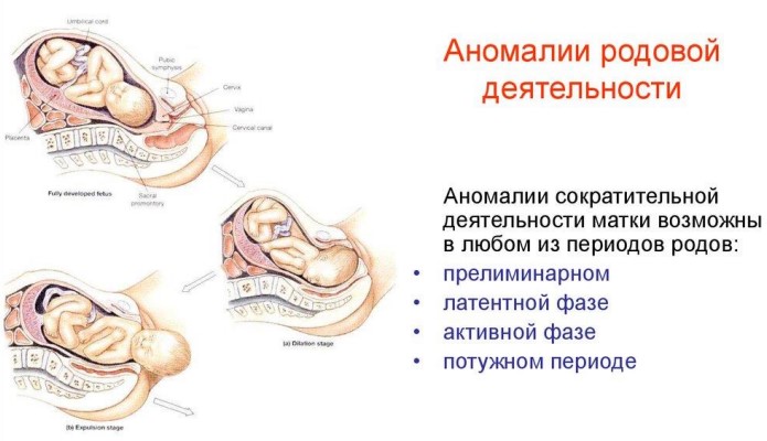 Миома матки. Чем опасна во время беременности, менопаузы