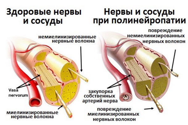 Тиолепта (Thiolepta). Инструкция по применению, цена