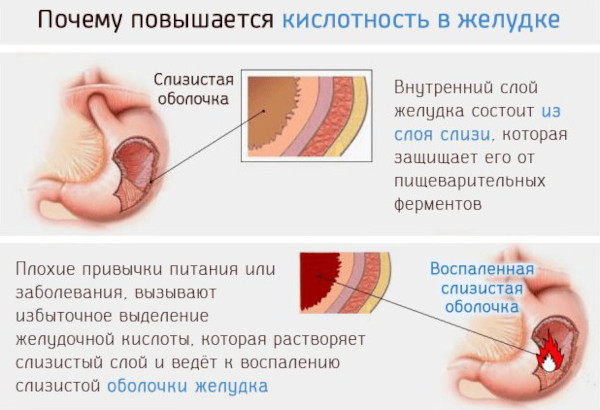 Пантопразол. Инструкция по применению, цена, отзывы