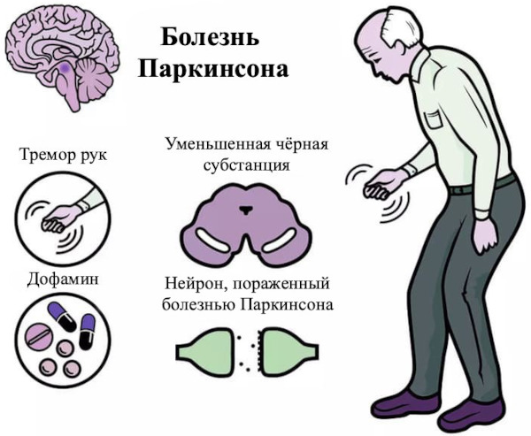 Предуктал ОД (Preductal OD). Показания и противопоказания