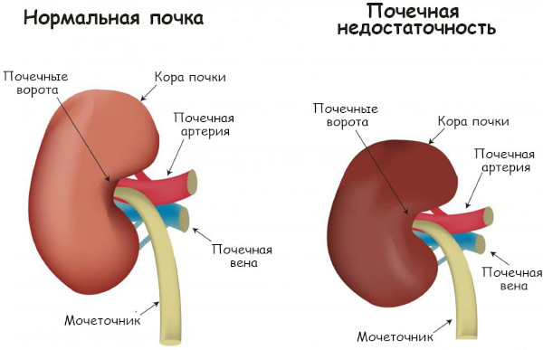 Предуктал ОД (Preductal OD). Показания и противопоказания