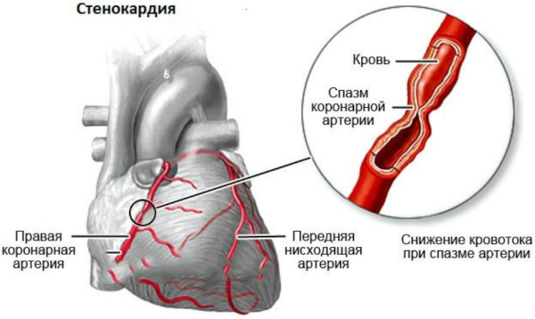 Предуктал ОД (Preductal OD). Показания и противопоказания