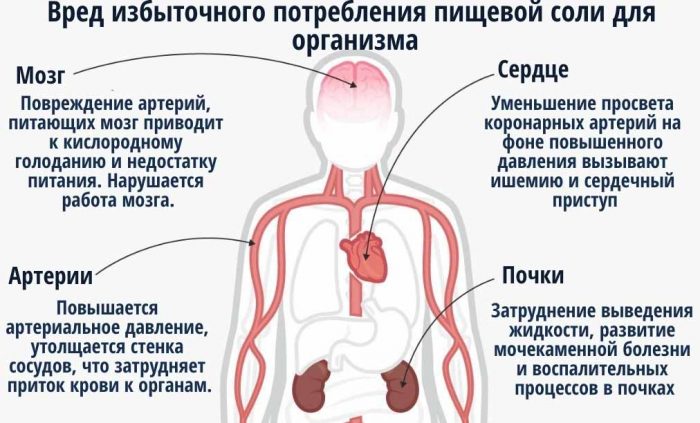 Профилактика гипертонической болезни