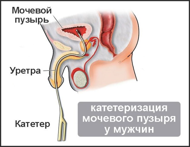 Гиповолемия. Что это такое, симптомы