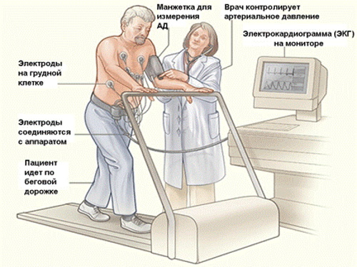 Реваскуляризация миокарда коронарная. Что это такое