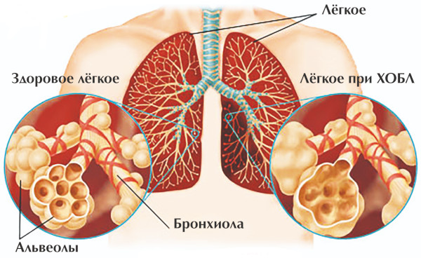 Сальбутамол (Salbutamol) таблетки. Инструкция по применению