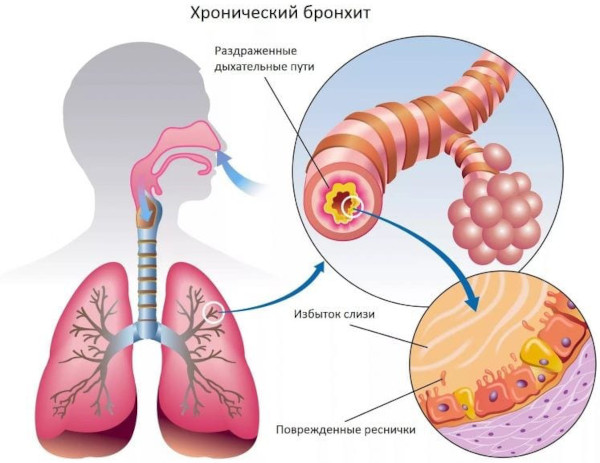 Сальбутамол (Salbutamol) таблетки. Инструкция по применению