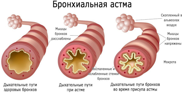 Сальбутамол (Salbutamol) таблетки. Инструкция по применению