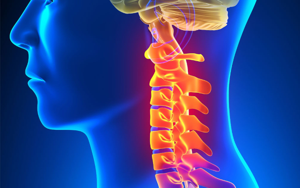 Спондилез шейного отдела позвоночника. Что это такое, лечение