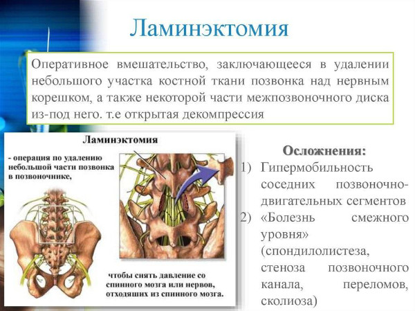 Спондилез шейного отдела позвоночника. Что это такое, лечение