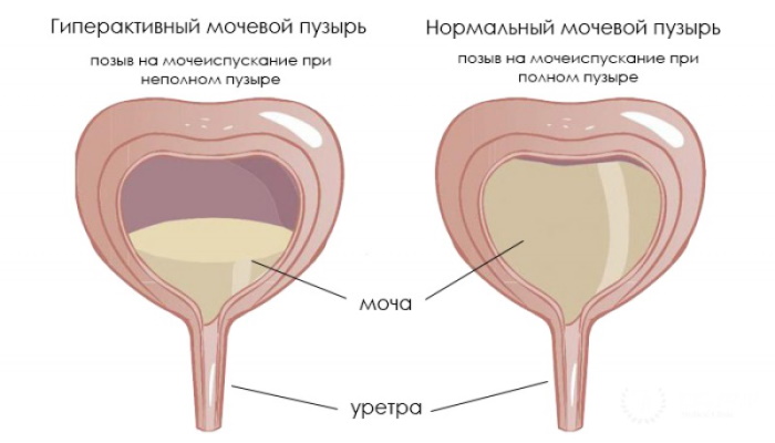 Заболевания прямой кишки. Классификация, симптомы, признаки