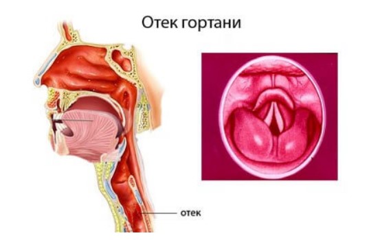 Уротропин. Инструкция по применению, цена, отзывы