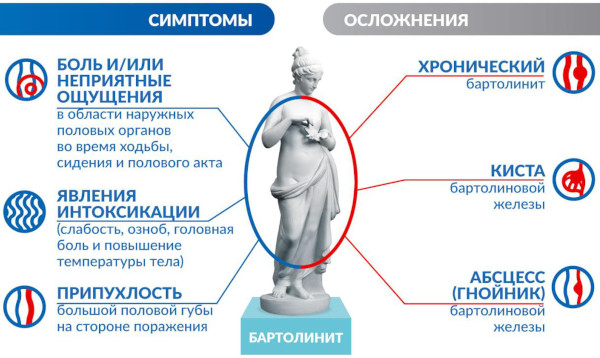 Бартолинит. Лечение в домашних условиях, мази, антибиотики