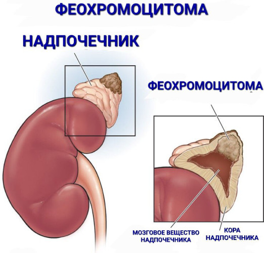 Бисопролол. Показания к применению, противопоказания