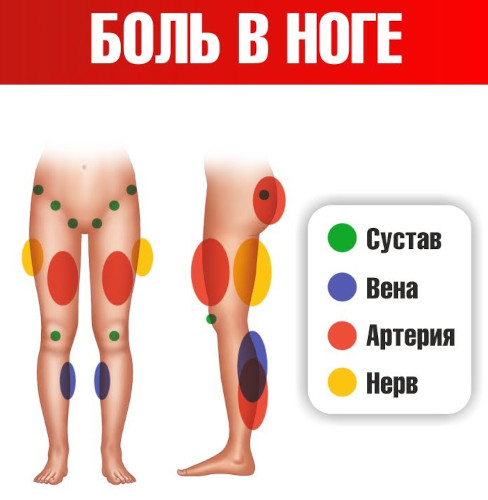 Боли в ногах: ноют от колена до ступни. Причины