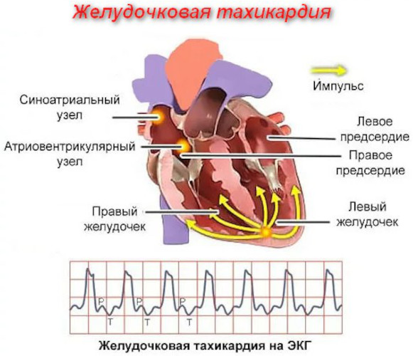 Дигоксин (Digoxin). Показания к применению, противопоказания