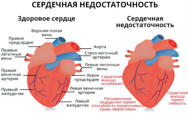 Дигоксин (Digoxin). Показания к применению, противопоказания